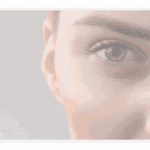 Laser skin resurfacing guide. Benefits, side effects, FAQs of laser skin resurfacing with Thomas Walker, MD in Atlanta, GA