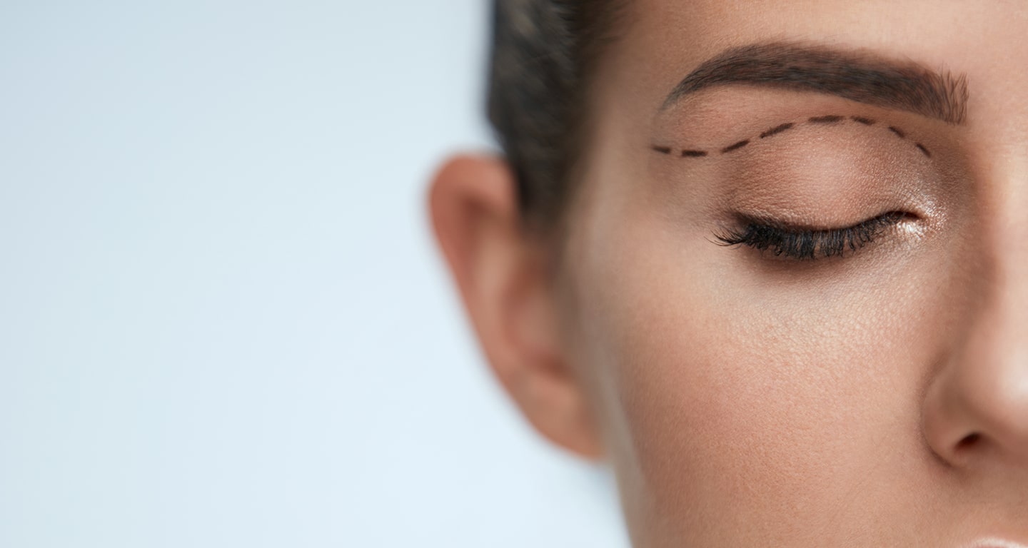 Eyelid-Surgery