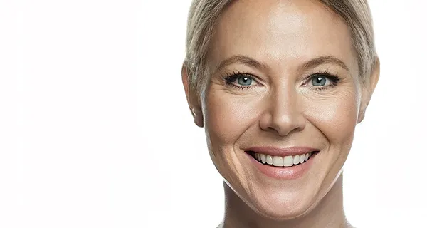 procedure-facelift-revision