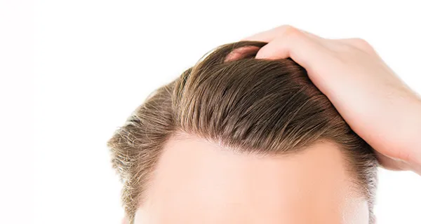 procedure-hair-restoration