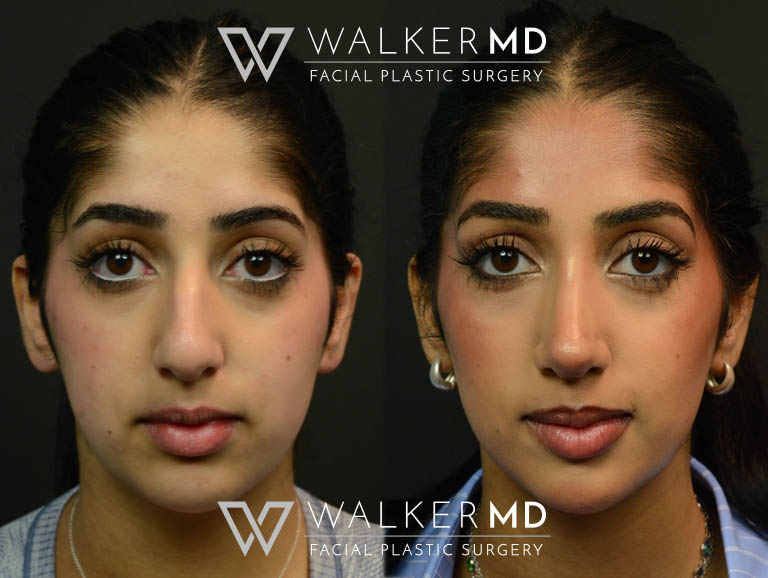1_0000_walkermd-footer-logo