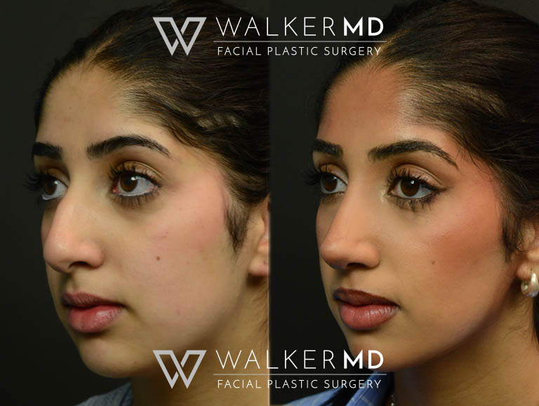 1_0001_walkermd-footer-logo