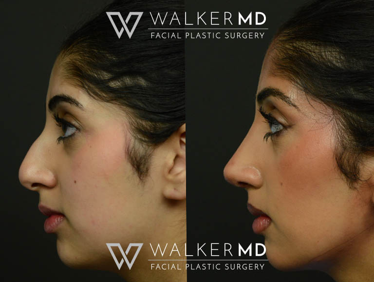 1_0002_walkermd-footer-logo