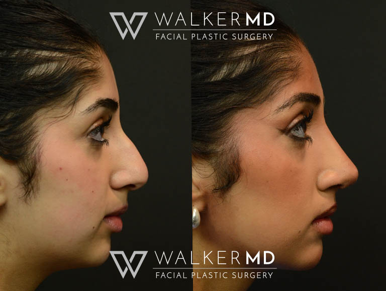 1_0004_walkermd-footer-logo